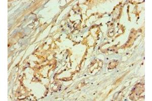 Immunohistochemistry of paraffin-embedded human prostate tissue using ABIN7167072 at dilution of 1:100