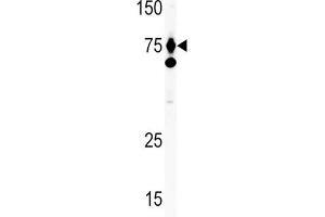 Western Blotting (WB) image for anti-Hepatocyte Growth Factor (Hepapoietin A, Scatter Factor) (HGF) antibody (ABIN2999319) (HGF Antikörper)