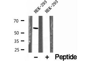 Western blot analysis of extracts of HEK-293 cells, using UGT2B7 antibody. (UGT2B7 Antikörper)