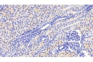 Detection of CASP2 in Human Kidney Tissue using Polyclonal Antibody to Caspase 2 (CASP2) (Caspase 2 Antikörper  (AA 334-452))
