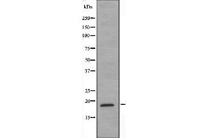 Western blot analysis of extracts from COLO205 cells, using NCBP2 antibody. (NCBP2 Antikörper  (N-Term))