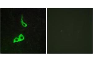 Immunofluorescence analysis of LOVO cells, using GPR153 Antibody. (GPR153 Antikörper  (AA 195-244))