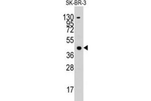 Western Blotting (WB) image for anti-Acetyl-CoA Acetyltransferase 1 (ACAT1) antibody (ABIN3003291) (ACAT1 Antikörper)