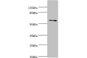 Western blot All lanes: DHCR24 antibody at 2 μg/mL + Jurkat whole cell lysate Secondary Goat polyclonal to rabbit IgG at 1/10000 dilution Predicted band size: 61, 55 kDa Observed band size: 61 kDa (Seladin 1 Antikörper  (AA 227-516))