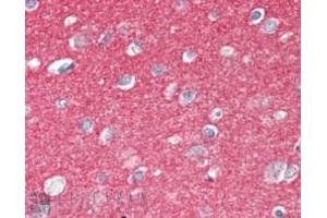 Immunohistochemistry (IHC) image for anti-Synaptosomal-Associated Protein, 25kDa (SNAP25) (C-Term) antibody (ABIN185392)