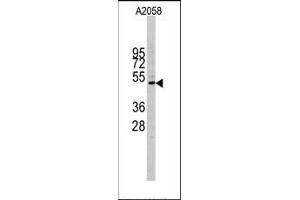 Image no. 1 for anti-Cyclin E1 (CCNE1) (C-Term) antibody (ABIN358767)