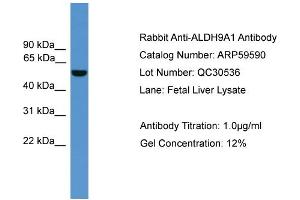 WB Suggested Anti-ALDH9A1  Antibody Titration: 0.