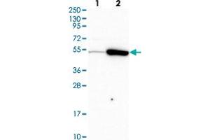 Western blot analysis of Lane 1: Human cell line RT-4 Lane 2: Human cell line U-251MG sp with TRIP6 polyclonal antibody  at 1:500-1:1000 dilution.