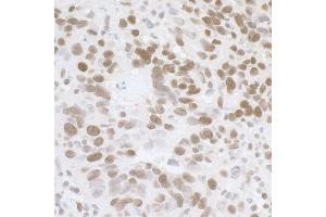Immunohistochemistry (IHC) image for anti-Fused in Sarcoma (FUS) (AA 1-50) antibody (ABIN7454607) (FUS Antikörper  (AA 1-50))