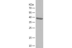 Western Blotting (WB) image for EH-Domain Containing 4 (EHD4) (AA 1-171) protein (His-IF2DI Tag) (ABIN7122751) (EHD4 Protein (AA 1-171) (His-IF2DI Tag))