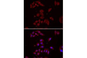 Immunofluorescence analysis of U2OS cell using NPHP1 antibody.