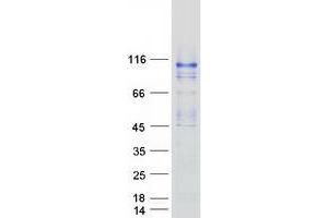 Western Blotting (WB) image for Oculocerebrorenal Syndrome of Lowe (OCRL) (Transcript Variant A) protein (Myc-DYKDDDDK Tag) (ABIN2727867)