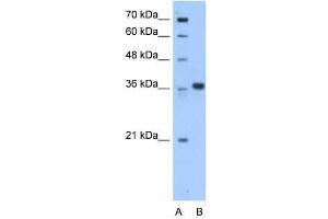 AASDHPPT antibody used at 0. (AASDHPPT Antikörper  (C-Term))