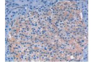 IHC-P analysis of Human Pancreas Tissue, with DAB staining. (LIF Antikörper  (AA 2-201))