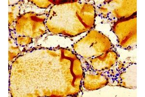 Immunohistochemistry of paraffin-embedded human thyroid tissue using ABIN7156373 at dilution of 1:100 (IGFBP6 Antikörper  (AA 32-161))