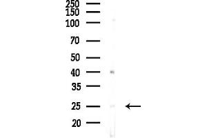 anti-Mitochondrial Ribosomal Protein L32 (MRPL32) (Internal Region) antibody