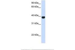 Image no. 1 for anti-Forkhead Box E1 (Thyroid Transcription Factor 2) (FOXE1) (AA 254-303) antibody (ABIN6737656) (FOXE1 Antikörper  (AA 254-303))