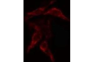 ABIN6268812 staining Hela cells by IF/ICC. (COL4a2 Antikörper  (N-Term))