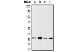 Western blot analysis of ARFIP1 expression in HeLa (A), SP2/0 (B), PC12 (C), rat muscle (D) whole cell lysates. (ARFIP1 Antikörper  (C-Term))