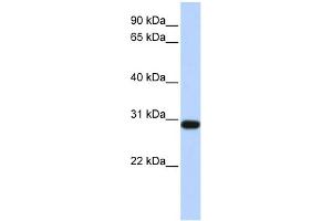 WB Suggested Anti-BPGM Antibody Titration: 0. (BPGM Antikörper  (Middle Region))