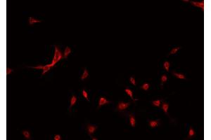 ABIN6269195 staining MCF-7 cells by IF/ICC. (GATA3 Antikörper)