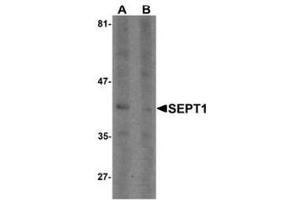 Western blot analysis of SEPT1 in Raji cell lysate with SEPT1 Antibody  at 1 µg/ml in (A) the absence and (B) the presence of blocking peptide. (Septin 1 Antikörper  (C-Term))
