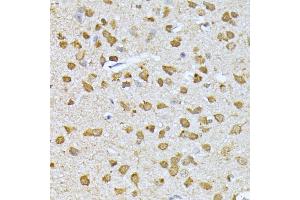 Immunohistochemistry of paraffin-embedded mouse brain using RPS27A antibody (ABIN3022728, ABIN3022729, ABIN1513489, ABIN1514633 and ABIN6219198) at dilution of 1:100 (40x lens). (RPS27A Antikörper  (AA 1-156))