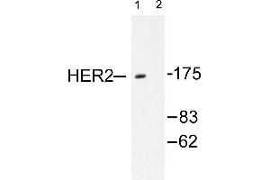 Image no. 1 for anti-Receptor tyrosine-protein kinase erbB-2 (ErbB2/Her2) antibody (ABIN265464) (ErbB2/Her2 Antikörper)
