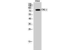 Western Blotting (WB) image for anti-Cyclic Nucleotide Gated Channel alpha 2 (CNGA2) (Internal Region) antibody (ABIN3174461) (CNGA2 Antikörper  (Internal Region))
