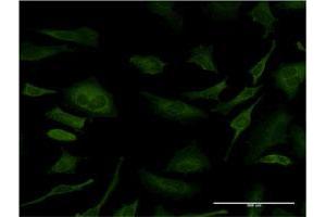 Immunofluorescence of monoclonal antibody to SFN on HeLa cell. (14-3-3 sigma/SFN Antikörper  (AA 1-248))