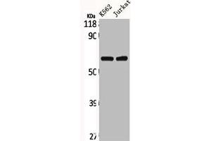Western Blot analysis of K562 Jurkat cells using CLCC1 Polyclonal Antibody (CLCC1 Antikörper  (Internal Region))