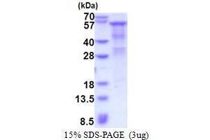HPSE Protein (AA 36-543) (His tag)