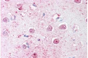 Human Brain, Cortex (formalin-fixed, paraffin-embedded) stained with LINGO1 antibody ABIN239799 at 20 ug/ml followed by biotinylated goat anti-rabbit IgG secondary antibody ABIN481713, alkaline phosphatase-streptavidin and chromogen. (LINGO1 Antikörper  (C-Term))