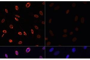 Immunofluorescence analysis of NIH/3T3 cells using Acetyl-Histone H3-K36 Polyclonal Antibody at dilution of 1:100. (Histone 3 Antikörper  (acLys36))