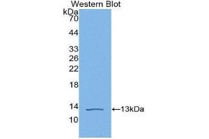 Western Blotting (WB) image for anti-Complement Component C4b (C4b) (AA 680-756) antibody (ABIN1866970)