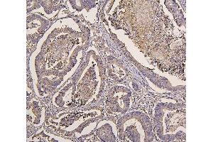IHC analysis of IRS1 using anti-IRS1 antibody (ABIN7599659). (IRS1 Antikörper  (AA 1041-1242))