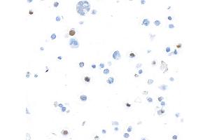 Immunocytochemistry (ICC) image for anti-Forkhead Box P3 (FOXP3) (AA 275-325) antibody (ABIN7455209) (Rekombinanter FOXP3 Antikörper  (AA 275-325))