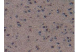 IHC-P analysis of Mouse Brain Tissue, with DAB staining. (NPPC Antikörper  (AA 30-126))