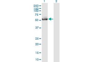 Western Blot analysis of IQCB1 expression in transfected 293T cell line by IQCB1 MaxPab polyclonal antibody. (IQCB1 Antikörper  (AA 1-465))