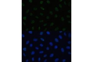 Immunofluorescence analysis of U2OS cells using HSF1 antibody (ABIN6131141, ABIN6142021, ABIN6142022 and ABIN6217875) at dilution of 1:100. (HSF1 Antikörper  (AA 350-529))