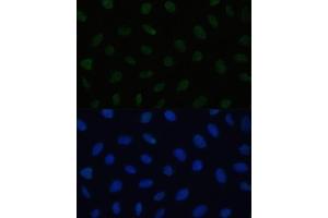 Immunofluorescence analysis of U2OS cells using HSF1 antibody (ABIN6131141, ABIN6142021, ABIN6142022 and ABIN6217875) at dilution of 1:100. (HSF1 Antikörper  (AA 350-529))