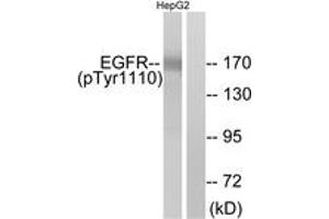 Western blot analysis of extracts from HepG2 cells, using EGFR (Phospho-Tyr1110) Antibody. (EGFR Antikörper  (pTyr1110))
