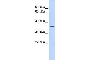 WB Suggested Anti-MMP23B Antibody Titration:  0. (MMP23B Antikörper  (Middle Region))