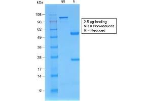 SDS-PAGE Analysis of Purified B2M Mouse Recombinant Monoclonal Antibody ABIN6383845. (Rekombinanter beta-2 Microglobulin Antikörper)