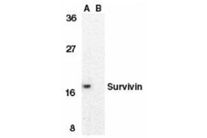 Western blot analysis of survivin in MOLT4 cell lysate in the absence (A) or presence (B) of blocking peptide with this product at 1 μg/ml. (Survivin Antikörper  (C-Term))