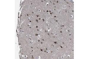 Immunohistochemical staining of human cerebral cortex with CCDC34 polyclonal antibody  shows moderate nuclear membrane positivity in neuronal cells at 1:500-1:1000 dilution. (CCDC34 Antikörper)