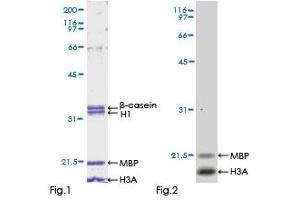 Kinase Activity Assay (KAA) image for Unc-51-Like Kinase 4 (ULK24) (AA 1-580) protein (GST tag) (ABIN1324629)