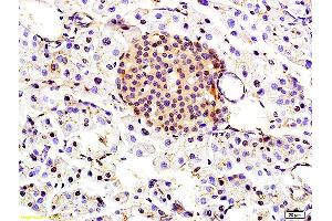 Formalin-fixed and paraffin embedded rat kidney labeled with Anti-TBRG1 Polyclonal Antibody, Unconjugated (ABIN706151) at 1:200 followed by conjugation to the secondary antibody and DAB staining (TBRG1 Antikörper  (AA 28-130))
