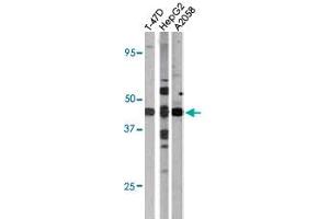 The E2F1 (phospho S337) polyclonal antibody  is used in Western blot to detect Phospho-E2F1-S337 in T-47D (left), HepG2 (middle), and A2058 (right) cell lysates (E2F1 Antikörper  (pSer337))