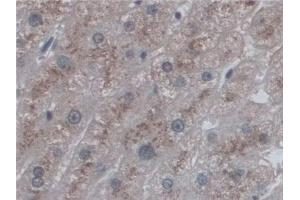 Detection of CD209 in Human Liver Tissue using Polyclonal Antibody to Cluster Of Differentiation 209 (CD209) (DC-SIGN/CD209 Antikörper  (AA 70-404))